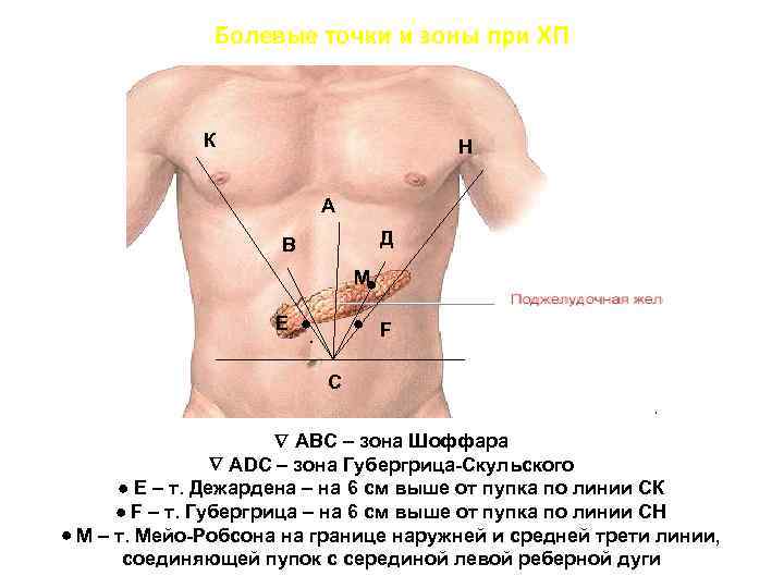 Болевые точки и зоны при ХП К Н А Д В М Е .