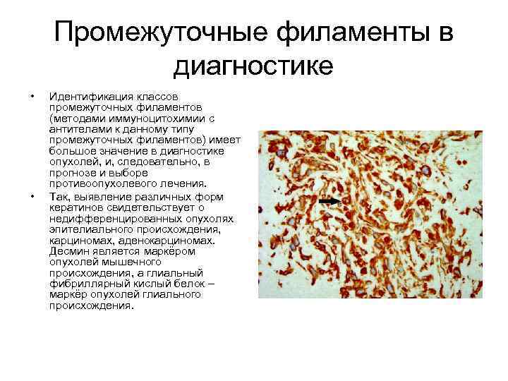Промежуточные филаменты в диагностике • • Идентификация классов промежуточных филаментов (методами иммуноцитохимии с антителами