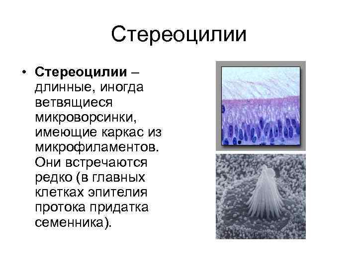 Стереоцилии • Стереоцилии – длинные, иногда ветвящиеся микроворсинки, имеющие каркас из микрофиламентов. Они встречаются