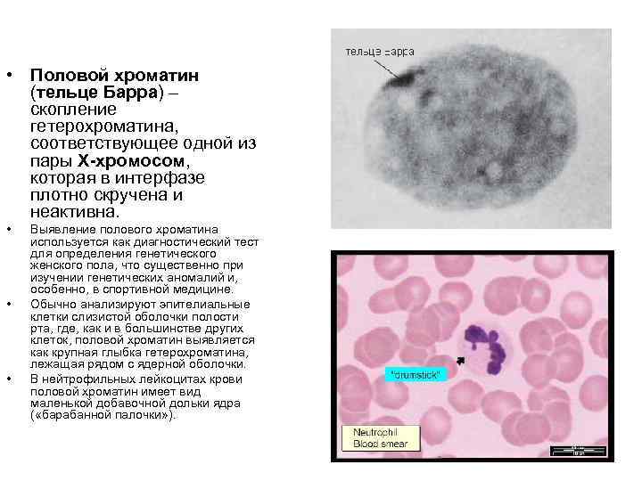  • Половой хроматин (тельце Барра) – скопление гетерохроматина, соответствующее одной из пары Х-хромосом,