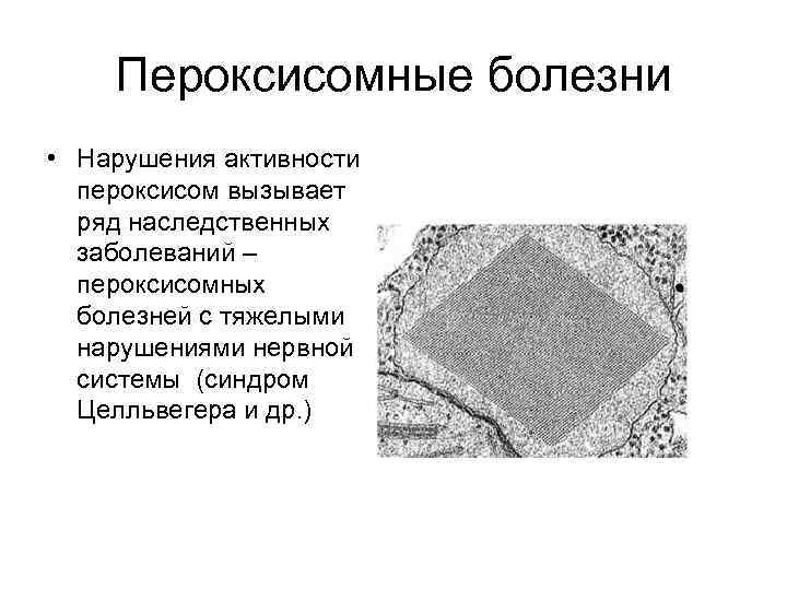 Пероксисомные болезни • Нарушения активности пероксисом вызывает ряд наследственных заболеваний – пероксисомных болезней с