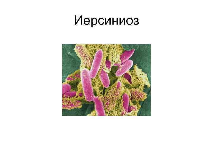 Иерсиниоз 