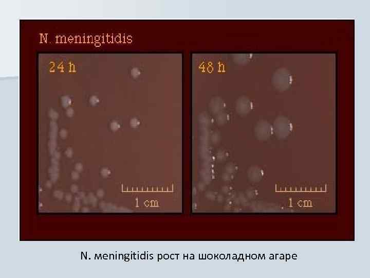 N. мeningitidis рост на шоколадном агаре 
