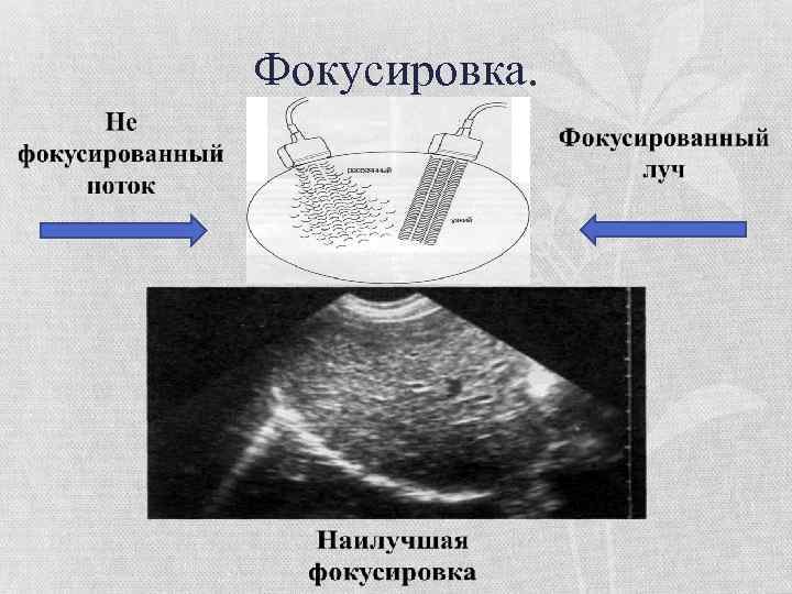 Ультразвук в стоматологии презентация