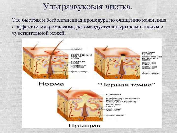 Чистка клапанов ультразвуком