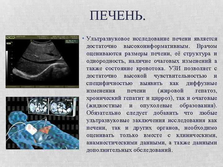 ПЕЧЕНЬ. • Ультразвуковое исследование печени является достаточно высокоинформативным. Врачом оцениваются размеры печени, её структура