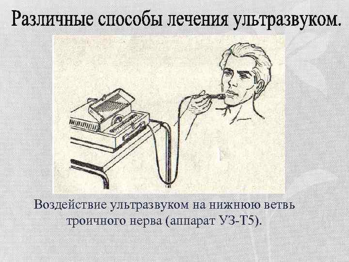 Воздействие ультразвуком на нижнюю ветвь троичного нерва (аппарат УЗ-Т 5). 