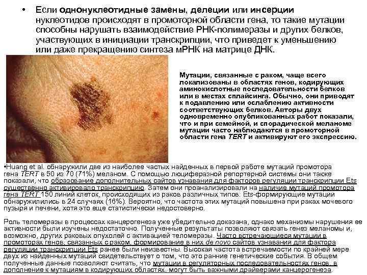  • Если однонуклеотидные замены, делеции или инсерции нуклеотидов происходят в промоторной области гена,