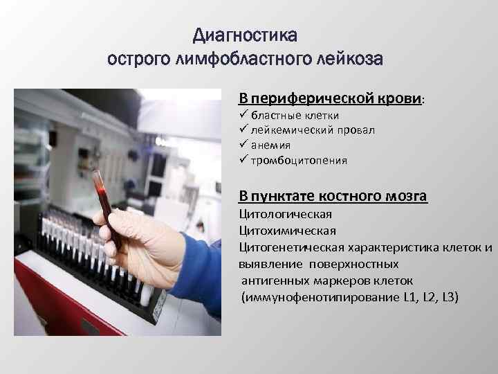 Диагностика острого лимфобластного лейкоза В периферической крови: ü бластные клетки ü лейкемический провал ü