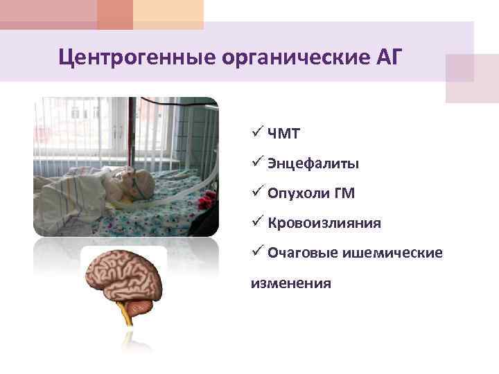 Центрогенные органические АГ ü ЧМТ ü Энцефалиты ü Опухоли ГМ ü Кровоизлияния ü Очаговые