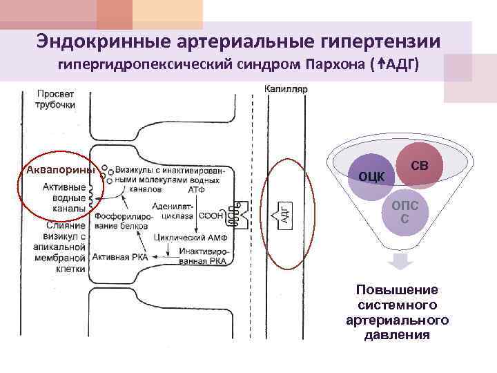 Синдром пархона презентация