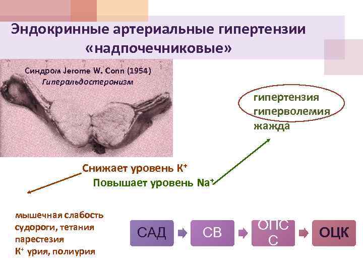 Синдром внутричерепной гипертензии патофизиологические механизмы клиническая картина