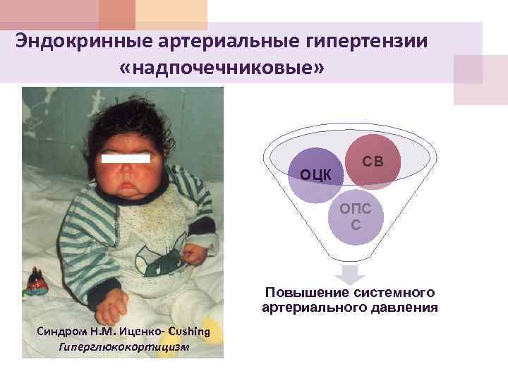 Эндокринные артериальные гипертензии «надпочечниковые» ОЦК СВ ОПС С Повышение системного артериального давления Синдром Н.