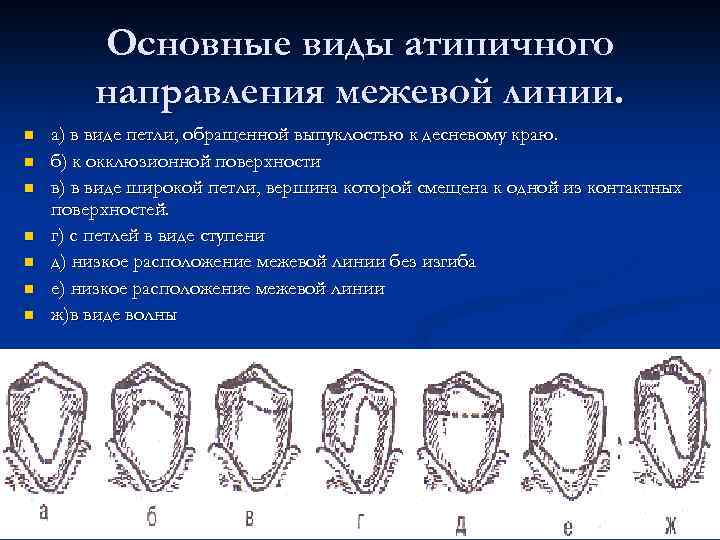 Основные виды атипичного направления межевой линии. n n n n а) в виде петли,