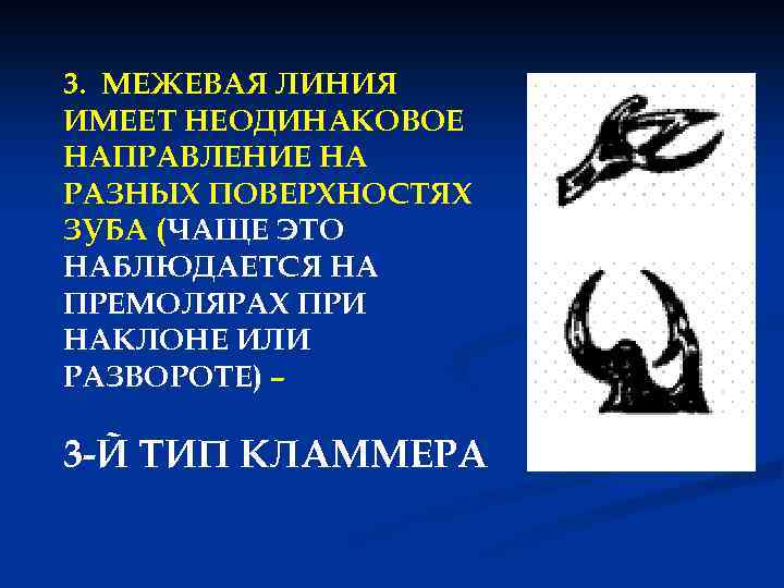 3. МЕЖЕВАЯ ЛИНИЯ ИМЕЕТ НЕОДИНАКОВОЕ НАПРАВЛЕНИЕ НА РАЗНЫХ ПОВЕРХНОСТЯХ ЗУБА (ЧАЩЕ ЭТО НАБЛЮДАЕТСЯ НА