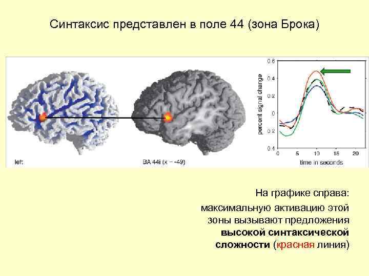 Синтаксис представлен в поле 44 (зона Брока) На графике справа: максимальную активацию этой зоны