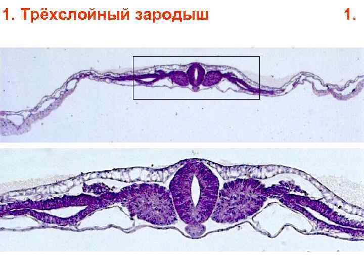 1. Трёхслойный зародыш 1. 