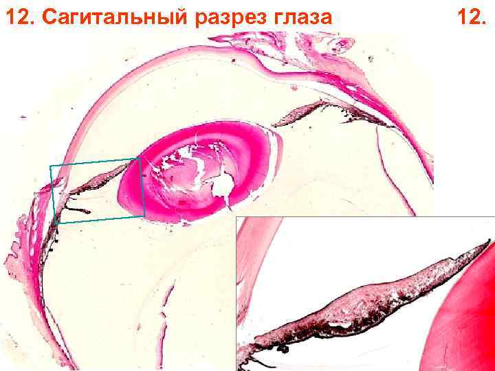 12. Сагитальный разрез глаза 12. 
