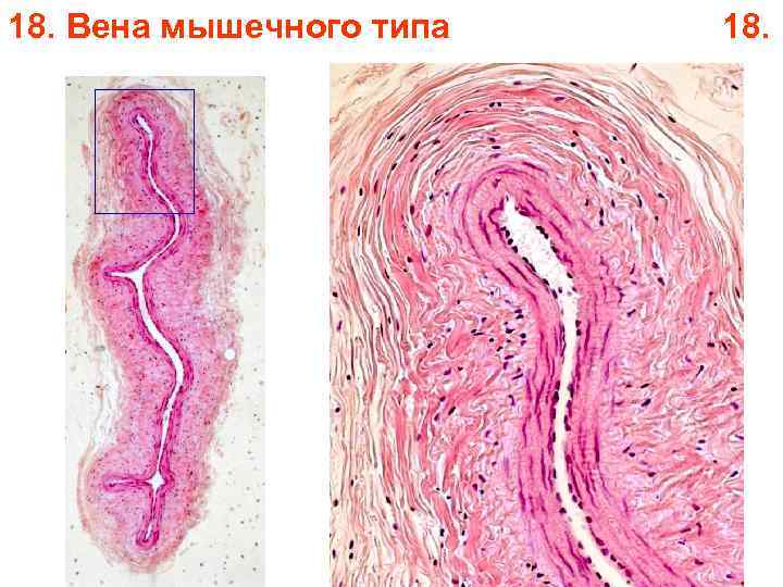 18. Вена мышечного типа 18. 