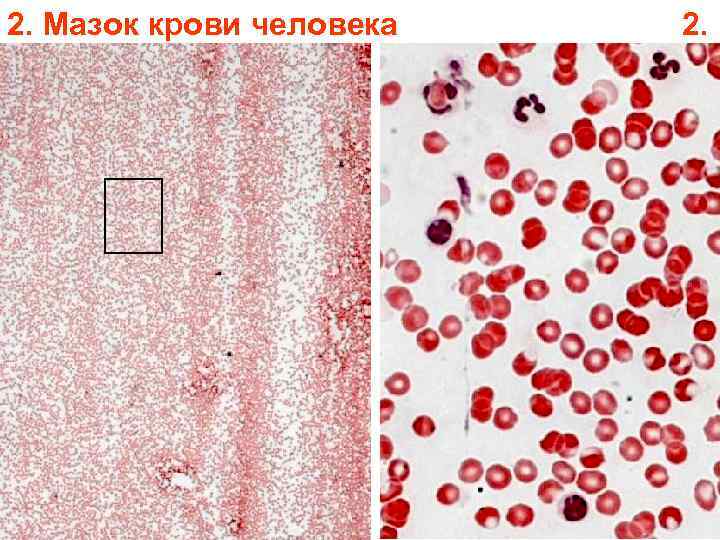 2. Мазок крови человека 2. 