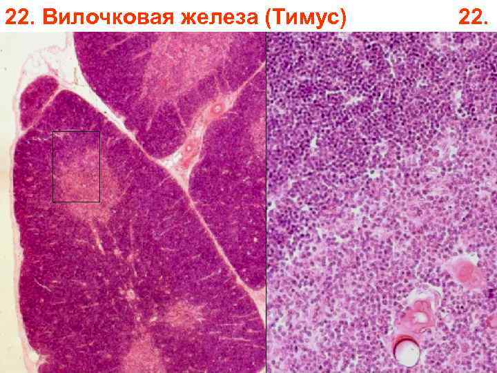 22. Вилочковая железа (Тимус) 22. 