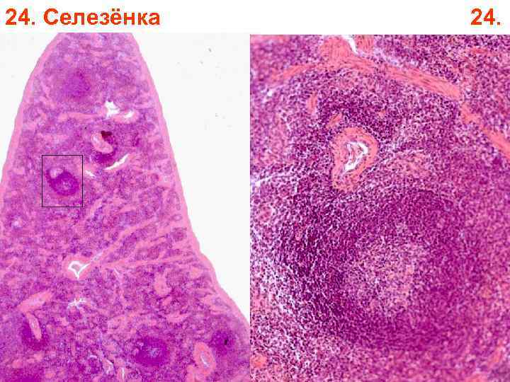 24. Селезёнка 24. 