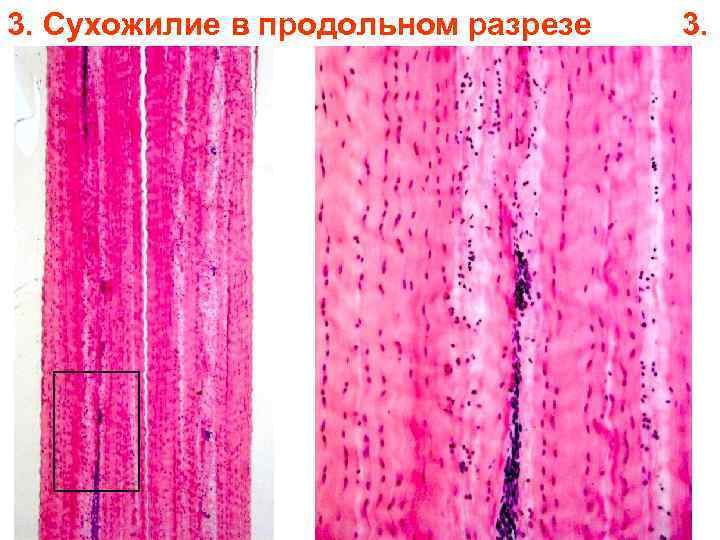3. Сухожилие в продольном разрезе 3. 