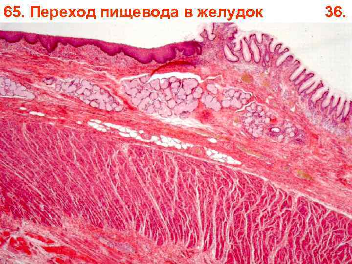 65. Переход пищевода в желудок 36. 