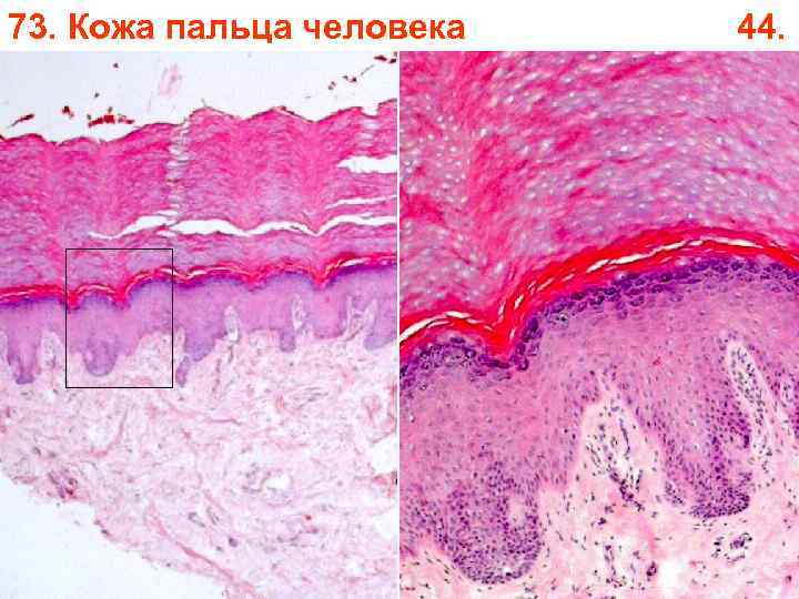 73. Кожа пальца человека 44. 