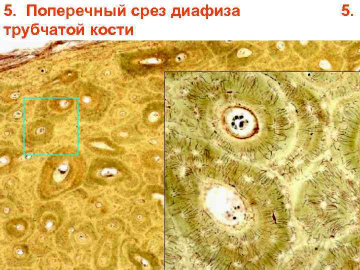 5. Поперечный срез диафиза трубчатой кости 5. 