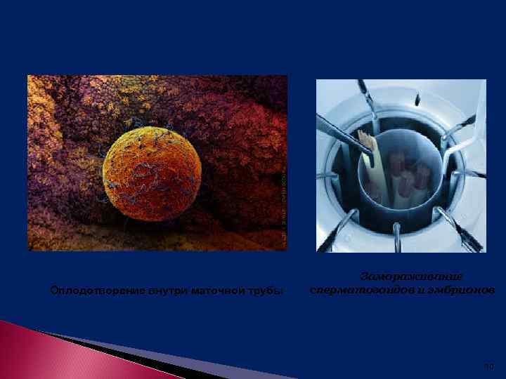 Оплодотворение внутри маточной трубы Замораживание сперматозоидов и эмбрионов 10 