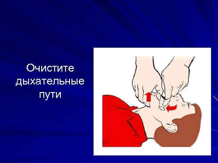 Очистите дыхательные пути 