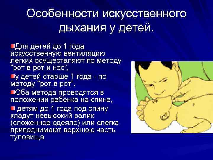 Особенности искусственного дыхания у детей. Для детей до 1 года искусственную вентиляцию легких осуществляют
