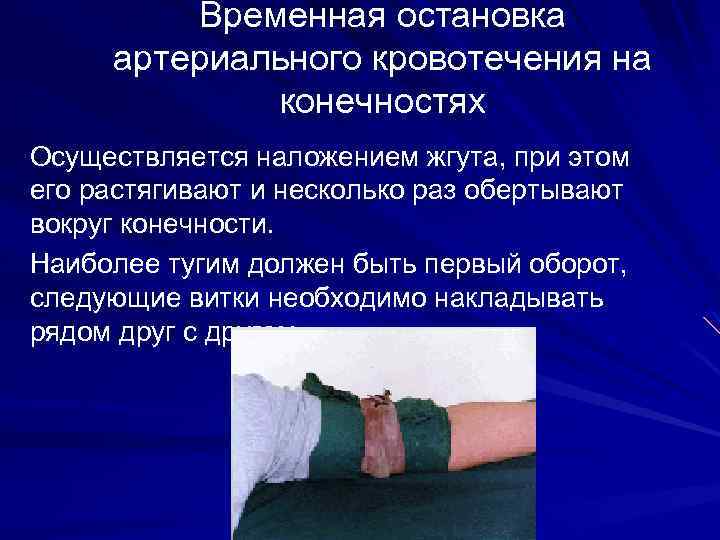 Временная остановка артериального кровотечения на конечностях Осуществляется наложением жгута, при этом его растягивают и