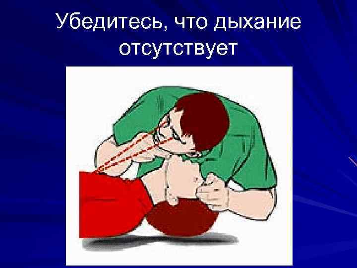 Убедитесь, что дыхание отсутствует 