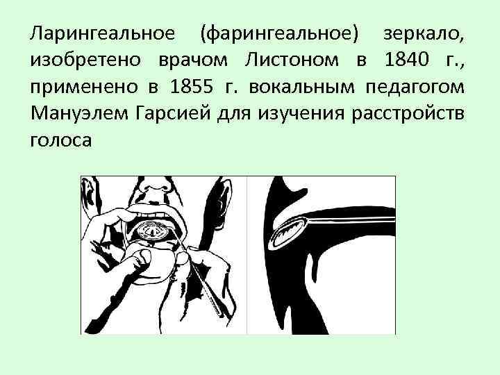 Ларингеальное (фарингеальное) зеркало, изобретено врачом Листоном в 1840 г. , применено в 1855 г.