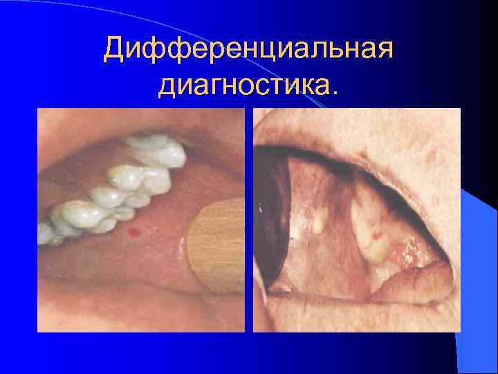 Дифференциальная диагностика. 