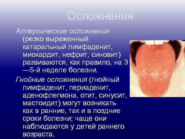 Осложнения Аллергические осложнения (резко выраженный катаральный лимфаденит, миокардит, нефрит, синовит) развиваются, как правило, на