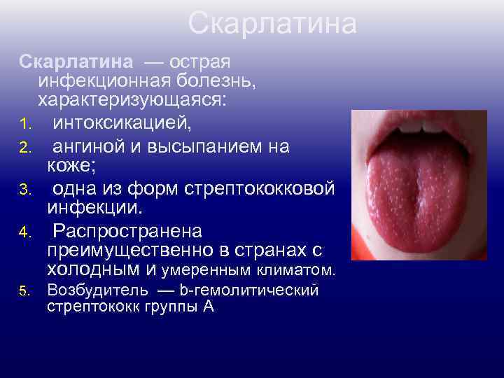 Скарлатина — острая инфекционная болезнь, характеризующаяся: 1. интоксикацией, 2. ангиной и высыпанием на коже;