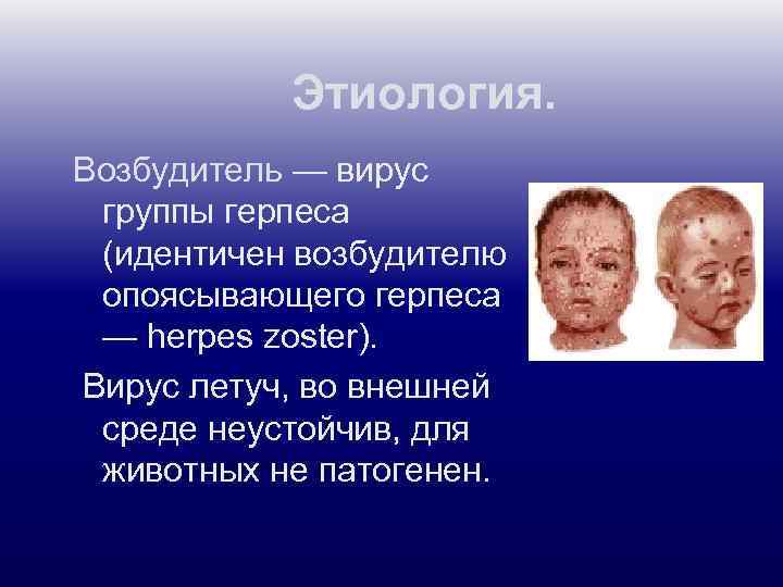 Этиология. Возбудитель — вирус группы герпеса (идентичен возбудителю опоясывающего герпеса — herpes zoster). Вирус