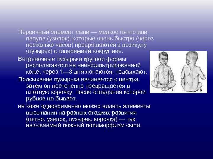 Первичный элемент сыпи — мелкое пятно или папула (узелок), которые очень быстро (через несколько