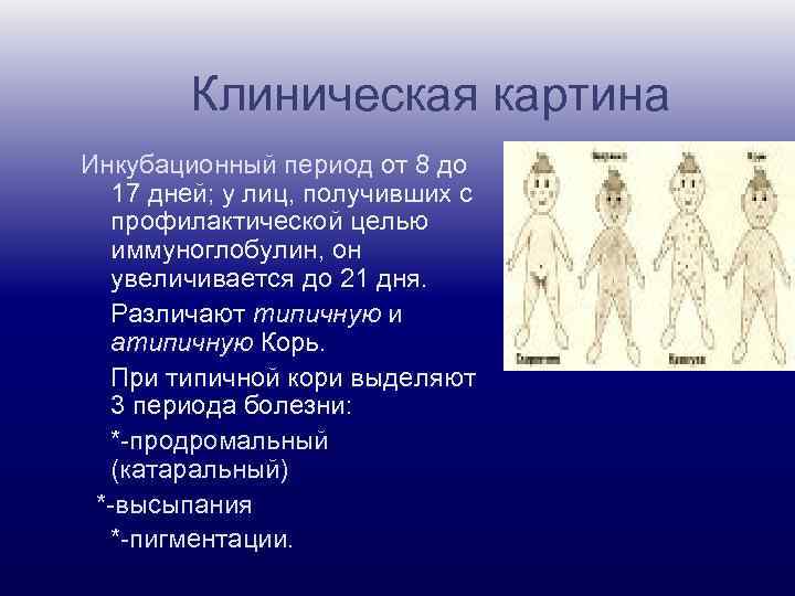 Клиническая картина Инкубационный период от 8 до 17 дней; у лиц, получивших с профилактической