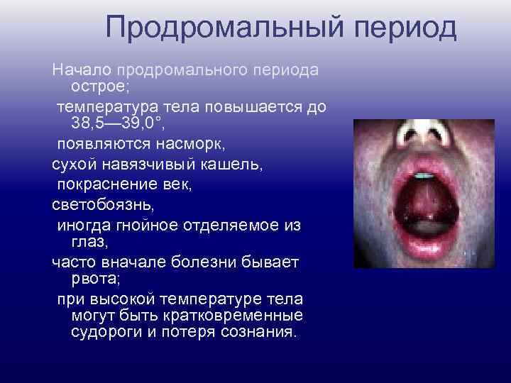 Продромальный период Начало продромального периода острое; температура тела повышается до 38, 5— 39, 0°,