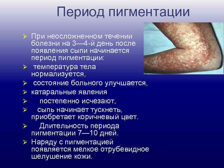 Период пигментации Ø Ø Ø Ø При неосложненном течении болезни на 3— 4 -й