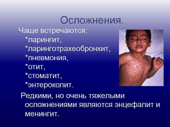 Осложнения. Чаще встречаются: *ларингит, *ларинготрахеобронхит, *пневмония, *отит, *стоматит, *энтероколит. Редкими, но очень тяжелыми осложнениями