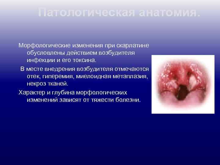 Патологическая анатомия. Морфологические изменения при скарлатине обусловлены действием возбудителя инфекции и его токсина. В