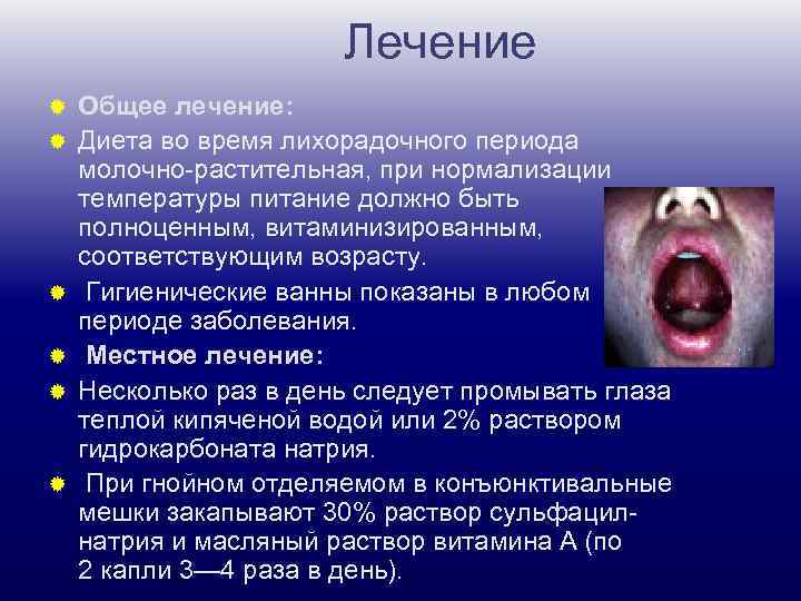 Лечение ® ® ® Общее лечение: Диета во время лихорадочного периода молочно-растительная, при нормализации