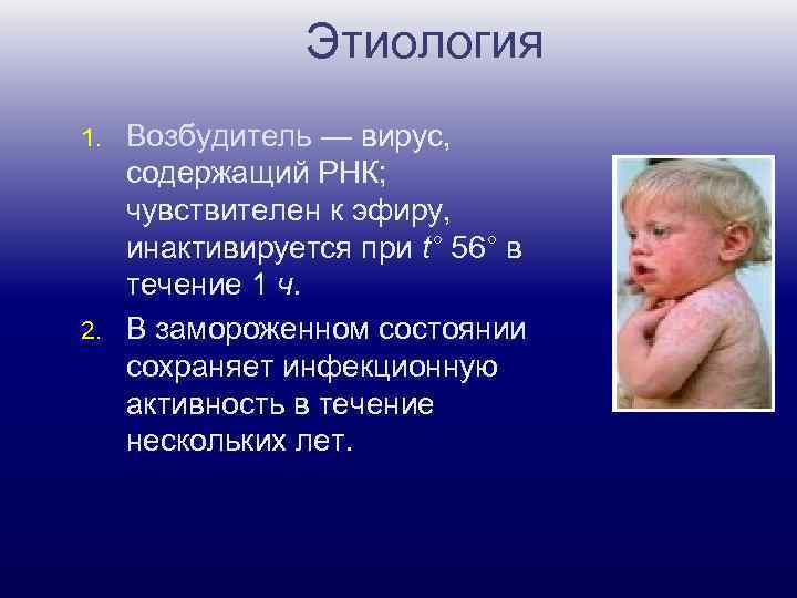 Этиология Возбудитель — вирус, содержащий РНК; чувствителен к эфиру, инактивируется при t° 56° в