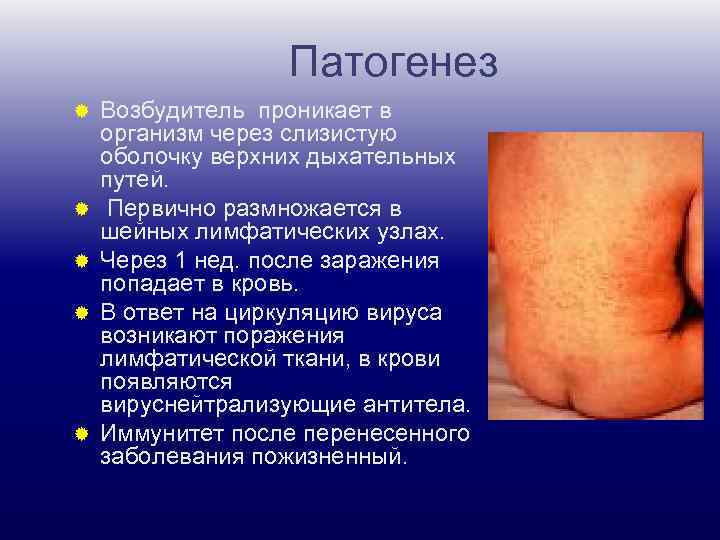 Патогенез ® ® ® Возбудитель проникает в организм через слизистую оболочку верхних дыхательных путей.