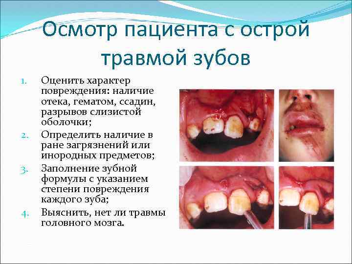 Осмотр пациента с острой травмой зубов 1. 2. 3. 4. Оценить характер повреждения: наличие